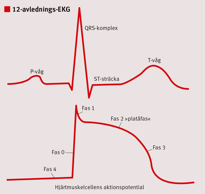 Tidig Repolarisation På EKG